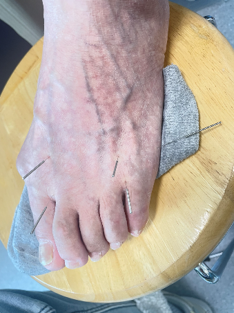 2026-03-10 14:28:59.058000