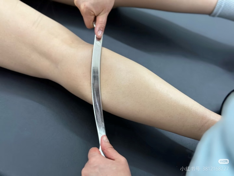 筋膜刀松解小腿后侧肌群