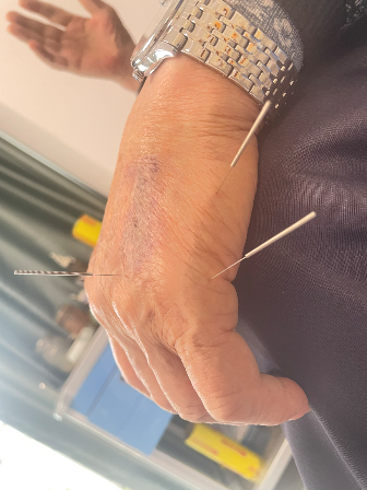 2026-03-10 14:28:58.615000