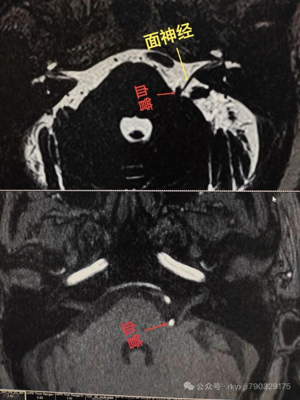 _cgi-bin_mmwebwx-bin_webwxgetmsgimg__&MsgID=8670482043127148049&skey=@crypt_8eca32d2_8d5c5e54889ebc407945c762c97bbffa&mmweb_appid=wx_webfilehelper