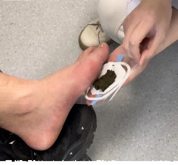 痛风散外敷贴 图片2