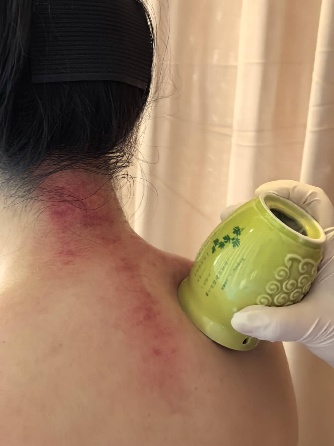 878ef23e2850d75cdf525fc8e4d803e