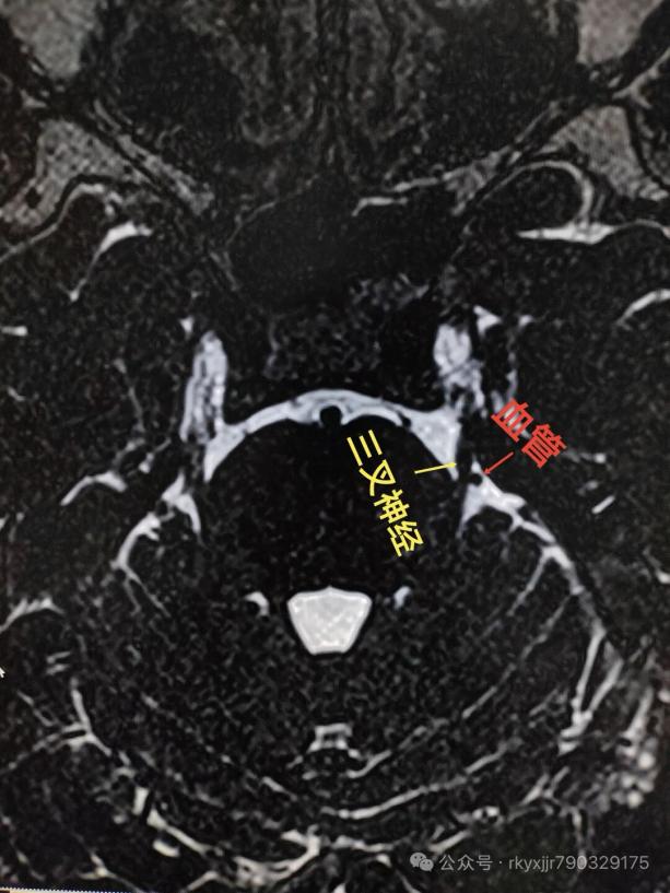 _cgi-bin_mmwebwx-bin_webwxgetmsgimg__&MsgID=8317235643919040694&skey=@crypt_8eca32d2_8d5c5e54889ebc407945c762c97bbffa&mmweb_appid=wx_webfilehelper