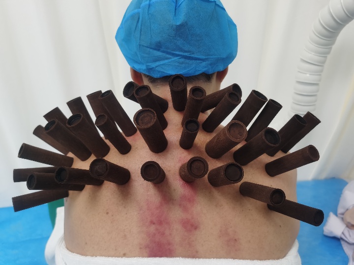 d6023651946e9c985e28533bc17c930